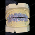 Jumbo Set Custom Diamond S925 Moissanite Grillz